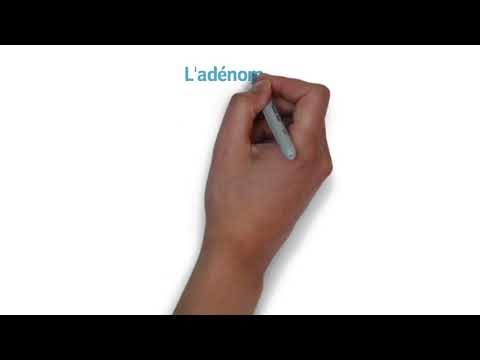 Vidéo: Adénomyose - Traitement De L'adénomyose Utérine Avec Des Remèdes Et Des Méthodes Populaires