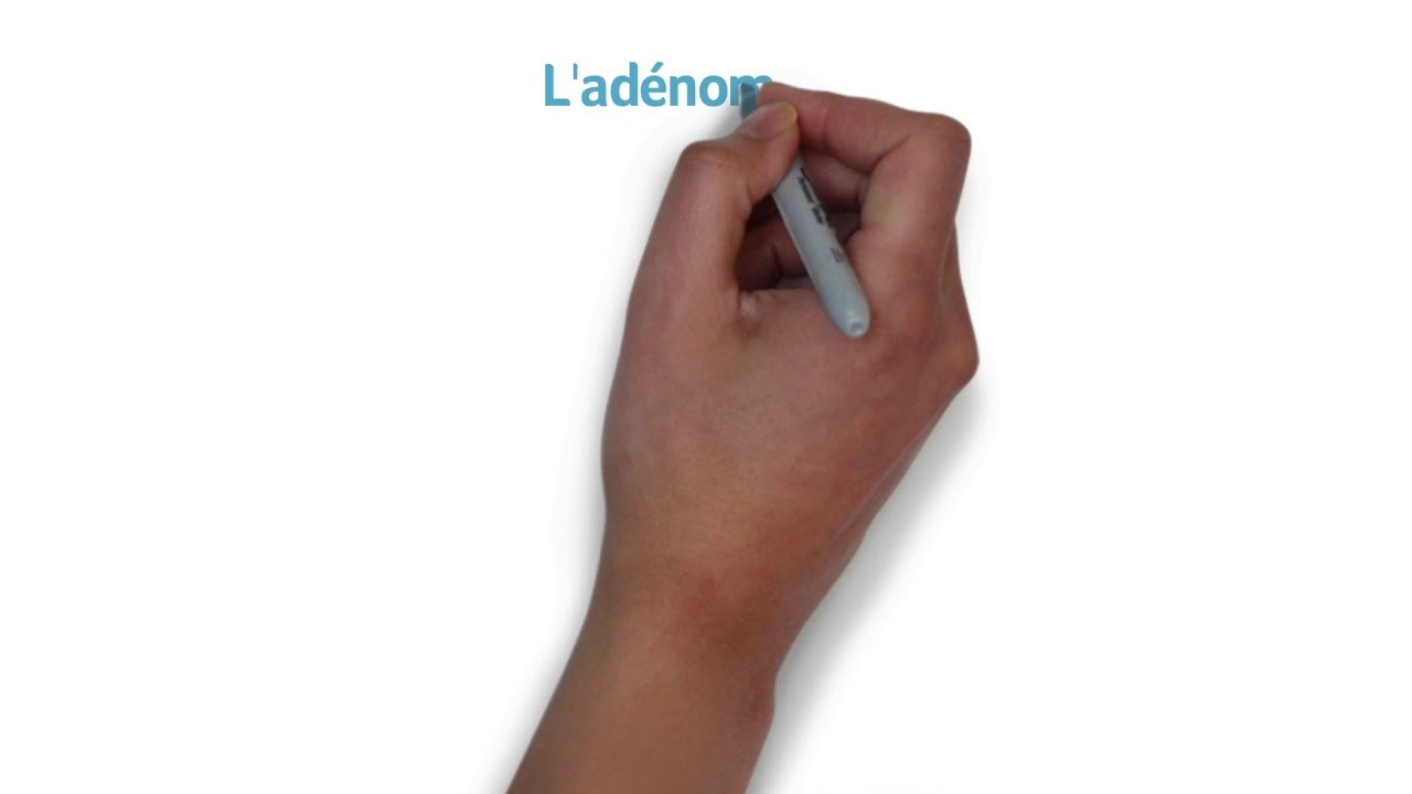 L'adénomyose... c'est quoi ?