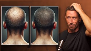 These Foods Can Prevent & Reverse Hair Loss
