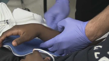 Distal Radius Fracture Reduction and Hematoma Block