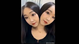 Conjoined/Two-Headed (A.I. compilation)