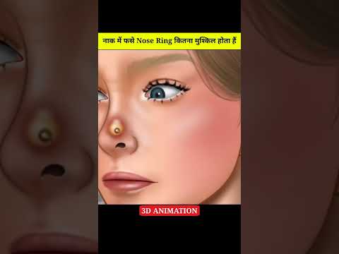 वीडियो: अपनी नाक में एक कट कैसे ठीक करें (चित्रों के साथ)