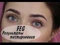 FEG - стимулятор роста ресниц/Есть ли результаты?  | MsAllatt