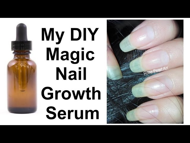 Nailgrowth Miracle Serum - Sally Hansen | Ulta Beauty