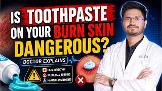 Stop Using Toothpaste on Burns! | Burn First Aid Tips by Dr. Sreeram | Sri Maruthi Hospital Tirupati