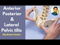 Anterior Pelvic tilt, Posterior Pelvic tilt  and Lateral Pelvic tilt (Simplified)