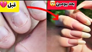 تطويل الاظافر في يومين فقط✅️👌🏻تبييض تقوية لمعان  الاظافر من أول مرة مجربة ومضمونه و فعاله 100% screenshot 4