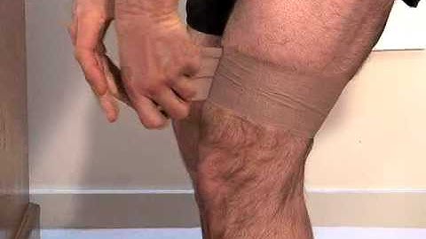 Effective sports taping for ITB syndrome at the knee