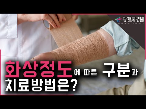 화상정도에 따른 구분과 치료방법