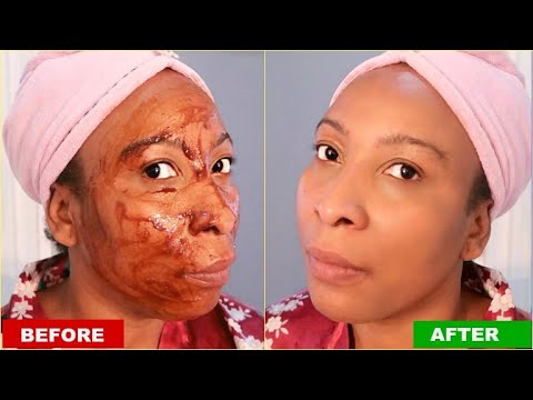 soften-your-face,-look-10-years-younger-using-this-amazing-anti---wrinkle-face-mask-amazing-results