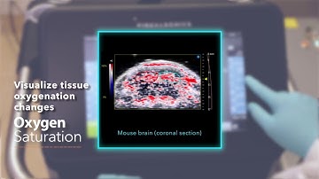 What do you get when you cross Optical Imaging with Ultrasound?
