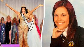 Beauty queen bullied for big chin wins Ms Galaxy 2026 | SWNS
