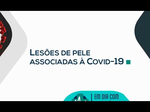 Em Dia Com A Saude Lesoes De Pele Associadas A Covid 19 Youtube