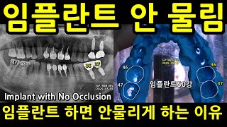 임플란트 안 물림. 이유와 해결책. 지르코니아 크라운하면  치과의사가 교합맞추기 귀찮아 안물리게 비정상적으로 제작. 교합검증영상. 임플란트50강 임플50강 2025_06_05