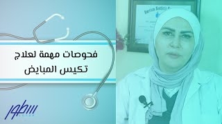 فحوصات مهمة لعلاج تكيس المبايض