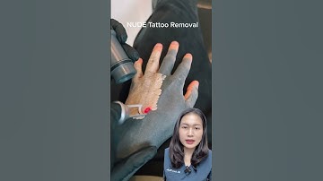 Xóa xăm laser có đau không? #shorts #bacsiluonghuyen #tips #xoaxam #laser
