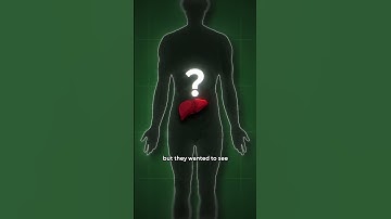 First Ever Successful Pig Liver Transplant for Human