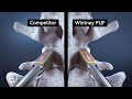 Lumbar Spine Surgery - Zavation Whitney PLIF - Ghost Productions Medical Animation &amp; Surgical VR
