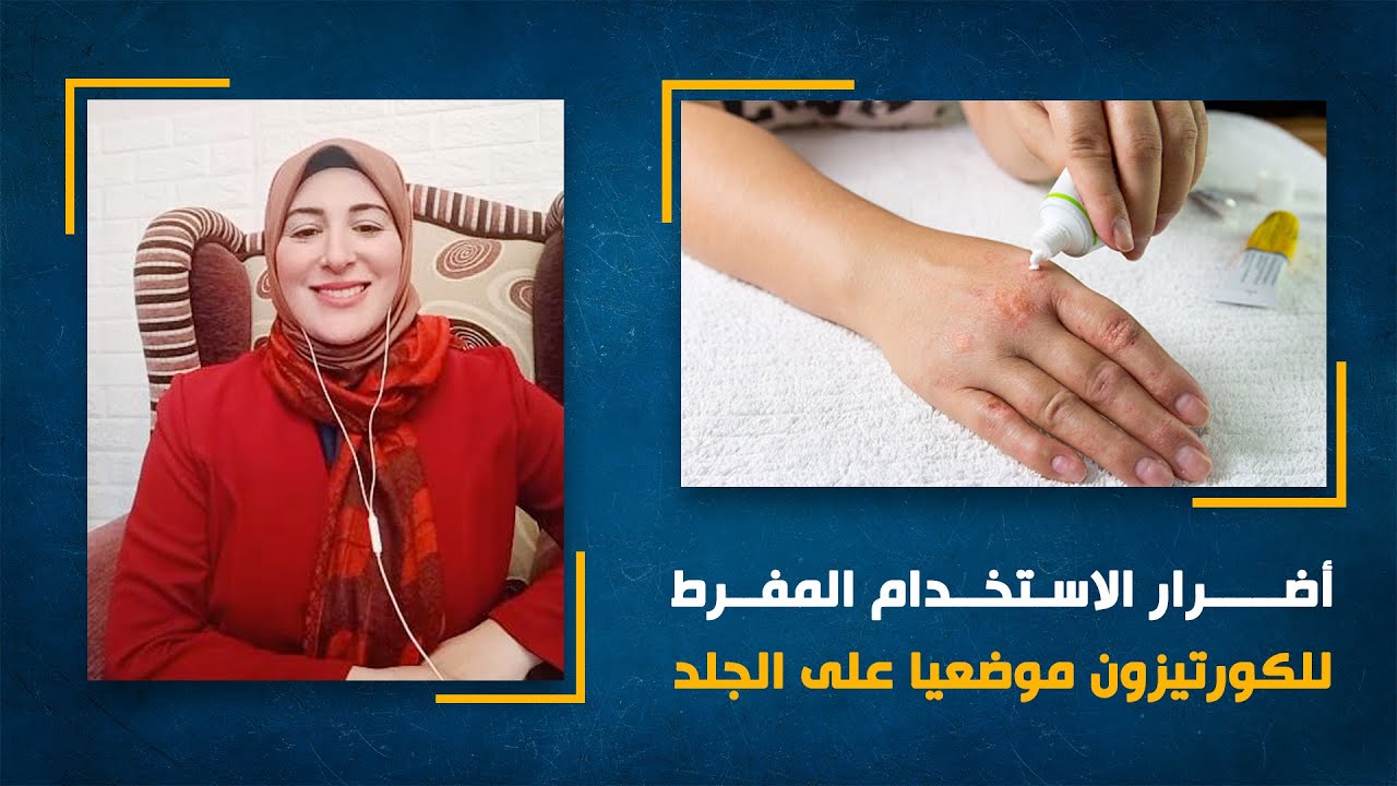 أضرار الاستخدام المفرط للكورتيزون موضعيا على الجلد