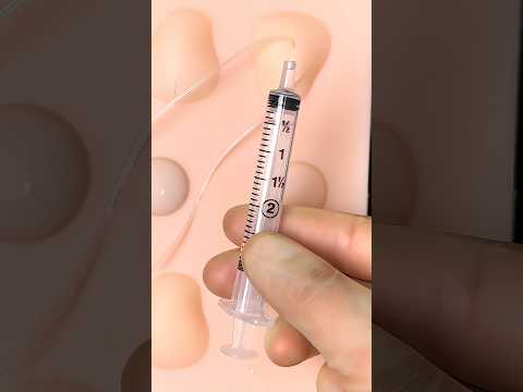 Drain Infected Cystcontribution.html
