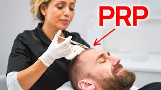 PRP treatment after hair transplant  FAST HAIR REGROWTH