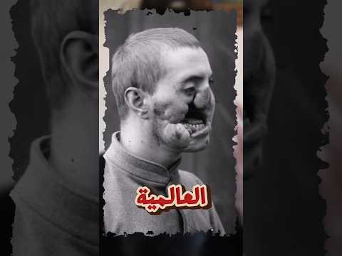 صور الجنود قبل و بعد الحرب العالمية الثانية ج1