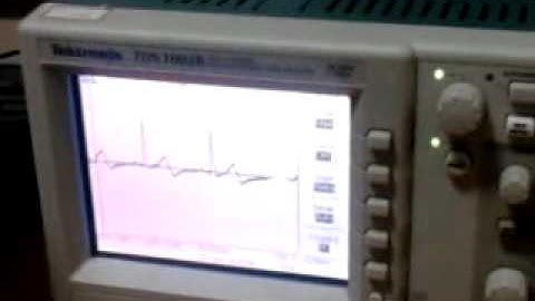 ECG on Oscilloscope