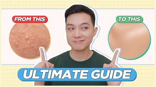 ULTIMATE GUIDE to Treat & Prevent BLACKHEADS, WHITEHEADS, TINY BUMPS for FILIPINO SKIN! | Jan Angelo by Jan Angelo 242,523 views 7 months ago 28 minutes