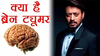 Irrfan Khan को हुई दिमागी बीमारी, जानें ट्यूमर की चपेट में कैसे आता है इंसान | Boldsky