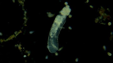 The Wonderful Dark-Field Microscopy World