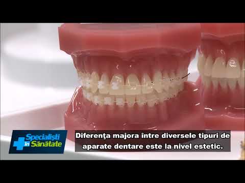 Video: 3 moduri de a avea grijă de aparatele dentare