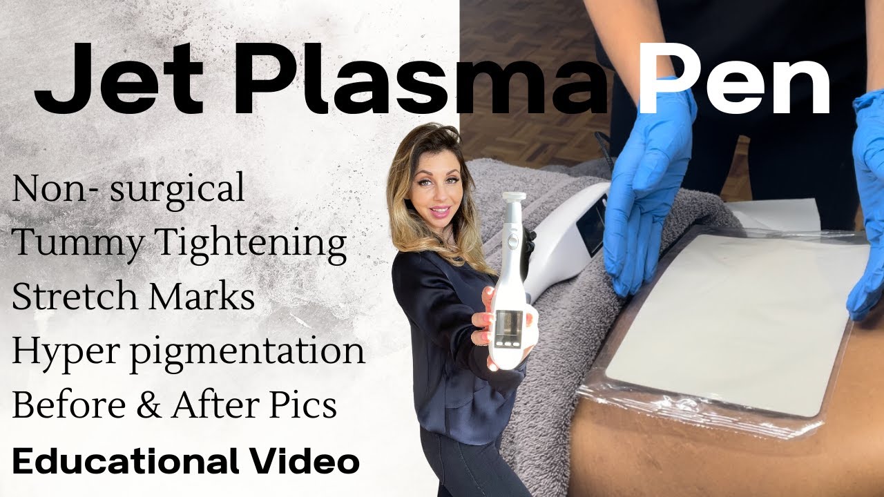 Jet Plasma Treatment- Tummy Tightening, Pigmentation, Stretch-marks