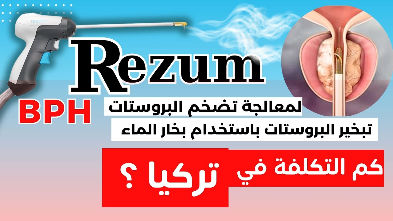تقنية رزيوم - التبخير المائي لعلاج تضخم البروستاتا ـ كم تكلفتها في تركيا؟ ولمن مناسب ؟؟ #رزيوم