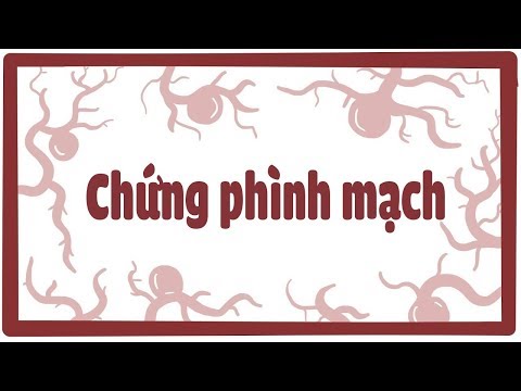 Video: Phình Mạch - Ngựa