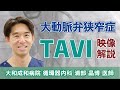 TAVIってどんな治療法？