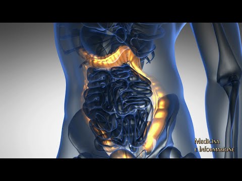 Malattia di Crohn e Rettocolite Ulcerosa: il ruolo dei farmaci biologici nel controllo di malattia