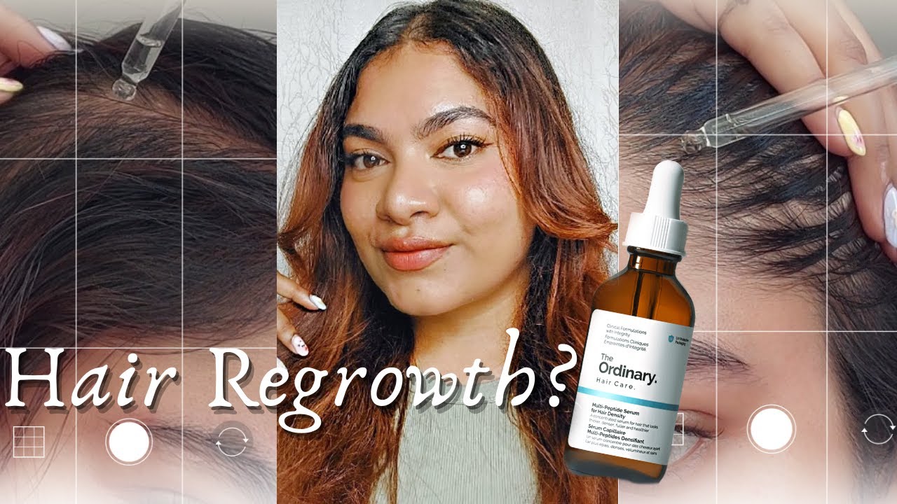 2 Months Results Of The Ordinary Multi Peptide Serum For Hair Growth 2-months-results-of-the-ordinary-multi-peptide-serum-for-hair-growth