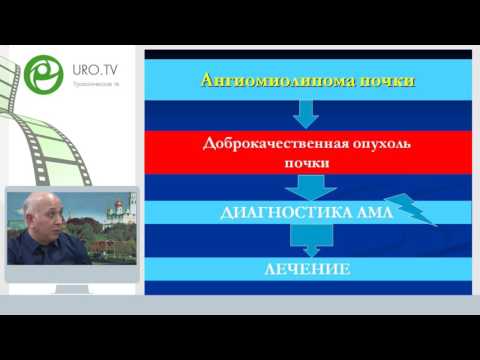 Гулиев Б Г - Ангиомиолипома: современные тенденции в лечении  Рекомендации EAU и AUA