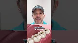 Why The 6-Year Molar Matters