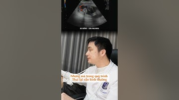 [BS ĐÀO NGỌC CƯỜNG]  Dây rốn bám màng