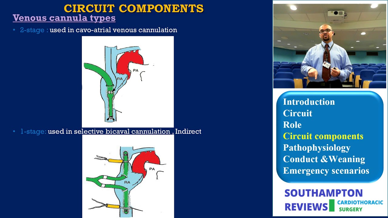 cardiopulmonary bypass cannulation