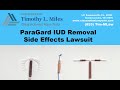 Paragard IUD Removal Side Effects Lawsuit https://www.classactionlawyertn.com/paragard-iud.html