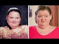 Amy Slaton before &amp; after 1000lb Sisters #shorts