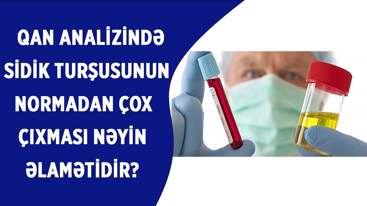 Qanın analizində sidik turşusunun normada və ya normadan çox olmağı nəyin əlamətidir?