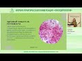 Скрининг рака шейки матки: стандартизация преаналитического этапа