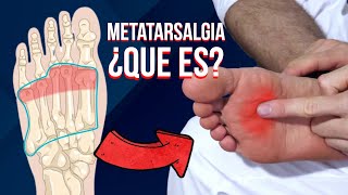 Que es la METATARSALGIA, causas, sintomas y tratamiento