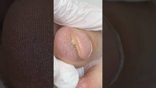 Download Lagu Poor toes… #fallintoshorts pedicure by @annavolodinafox MP3 Download Lagu Poor toes… #fallintoshorts pedicure by @annavolodinafox MP3