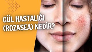 Köpekler Uyutulursa Keneler İnsanlara Geçer Oytun Erbaş-Ali̇ Tarakci