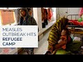 Measles spreads in Bangladesh Rohingya camp amid overcrowding