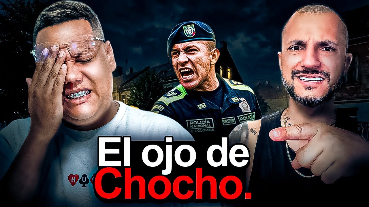 LA POLICIA LE DAÑO UN OJO | Anecdatario | El Muñe